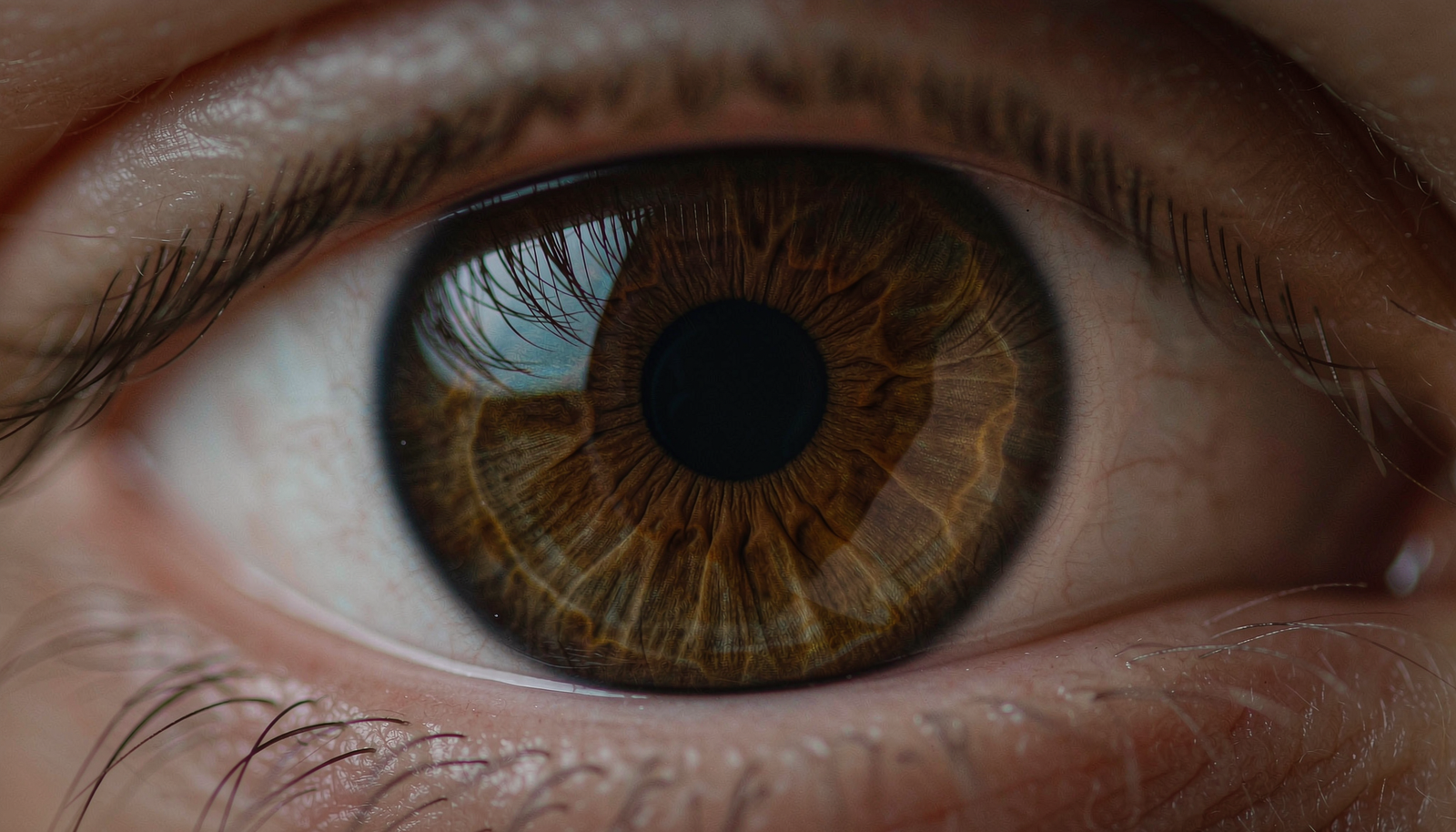 Heterocromia parcial mostrando diferentes cores na mesma íris